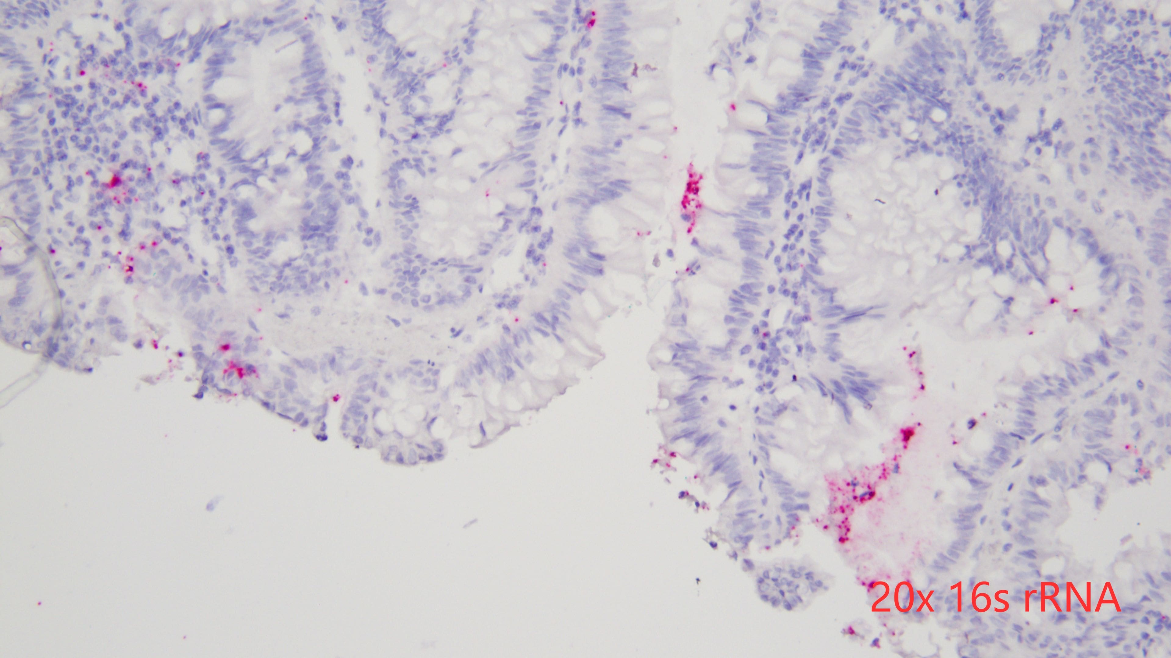 human intestine